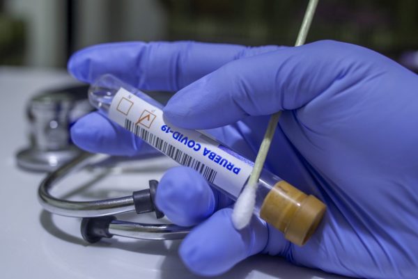 В области подтвердили еще один случай коронавируса, 17 человек выздоровели