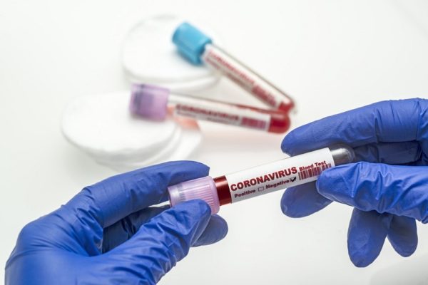 Известны результаты повторных тестов на коронавирус у александрийцев