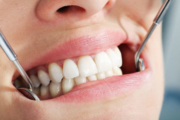ЦИС — качественное протезирование зубов доступное каждому