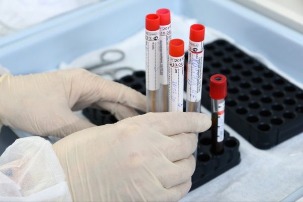 Александрийским медикам и учителям бесплатно сделают ИФА-тесты на выявление коронавируса