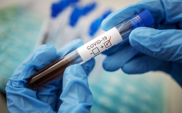 За сутки коронавирус выявили у 43 александрийцев, двое жителей Александрии умерли от COVID-19