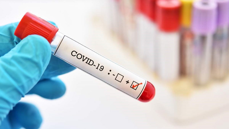 Оперативная информация о распространении COVID-19 и пневмонии в Александрии