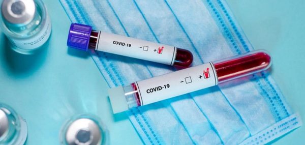 Оперативная информация о распространении COVID-19 и пневмонии в Александрии