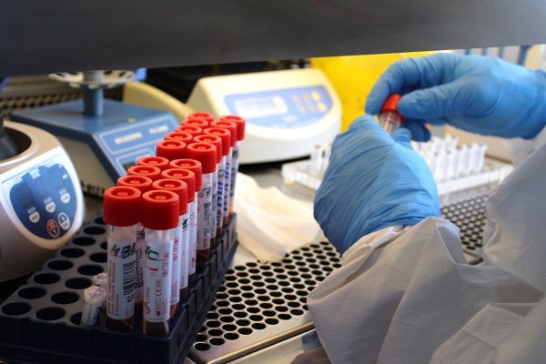 За сутки в Александрии подтвердили 25 новых случаев коронавирусной болезни