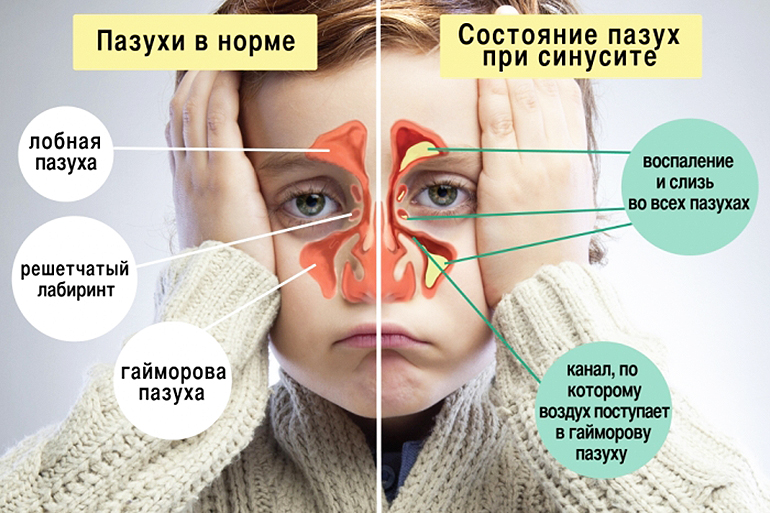 Диагностика заложенности носа у ребенка